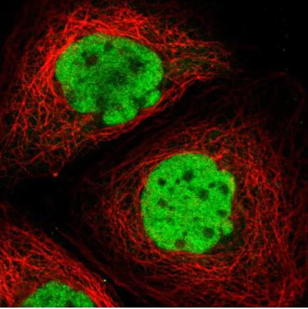 Immunocytochemistry/ Immunofluorescence - Anti-c-Fos antibody (AB209794)