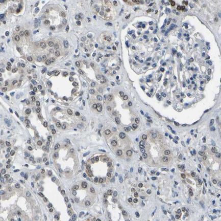 Immunohistochemistry (Formalin/PFA-fixed paraffin-embedded sections) - Anti-c-Fos antibody (AB209794)