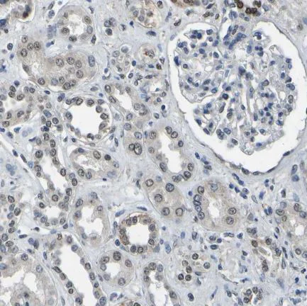 Immunohistochemistry (Formalin/PFA-fixed paraffin-embedded sections) - Anti-c-Fos antibody (AB209794)