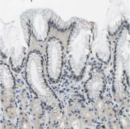 Immunohistochemistry (Formalin/PFA-fixed paraffin-embedded sections) - Anti-c-Fos antibody (AB209794)