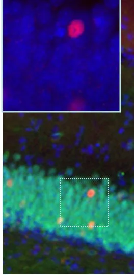 Immunohistochemistry (Formalin/PFA-fixed paraffin-embedded sections) - Anti-c-Fos antibody - BSA free (AB190289)