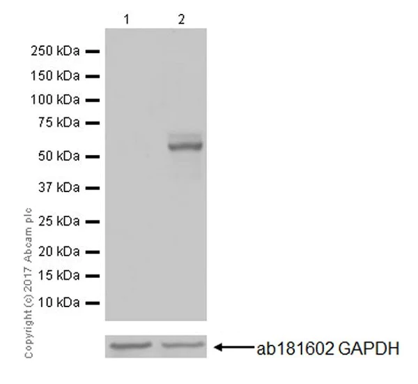 Western blot - Anti-c-Fos antibody [EPR20769] (AB214672)
