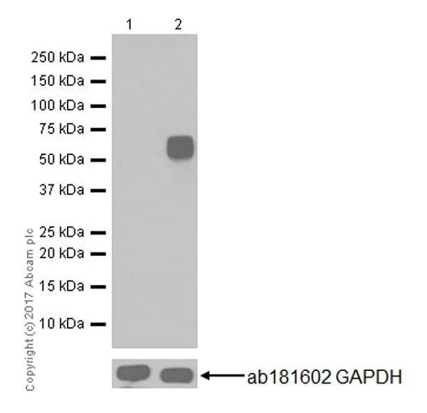 Western blot - Anti-c-Fos antibody [EPR20769] (AB214672)