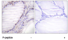 Immunohistochemistry (Formalin/PFA-fixed paraffin-embedded sections) - Anti-c-Fos (phospho S362) antibody (AB63444)