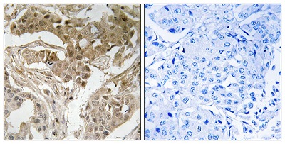 Immunohistochemistry (Formalin/PFA-fixed paraffin-embedded sections) - Anti-c-Fos (phospho T232) antibody (AB193365)