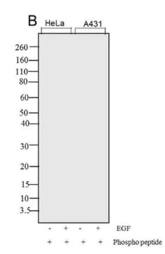 Western blot - Anti-c-Fos (phospho T232) antibody [RP23040102] (AB308128)
