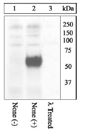 Western blot - Anti-c-Fos (phospho T325) antibody (AB27793), expandable thumbnail