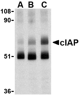 Western blot - Anti-c-IAP1 and c-IAP2 antibody (AB25939)
