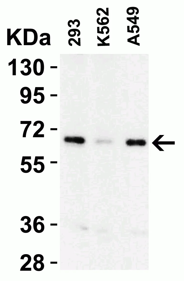 Western blot - Anti-c-IAP1 and c-IAP2 antibody (AB25939)