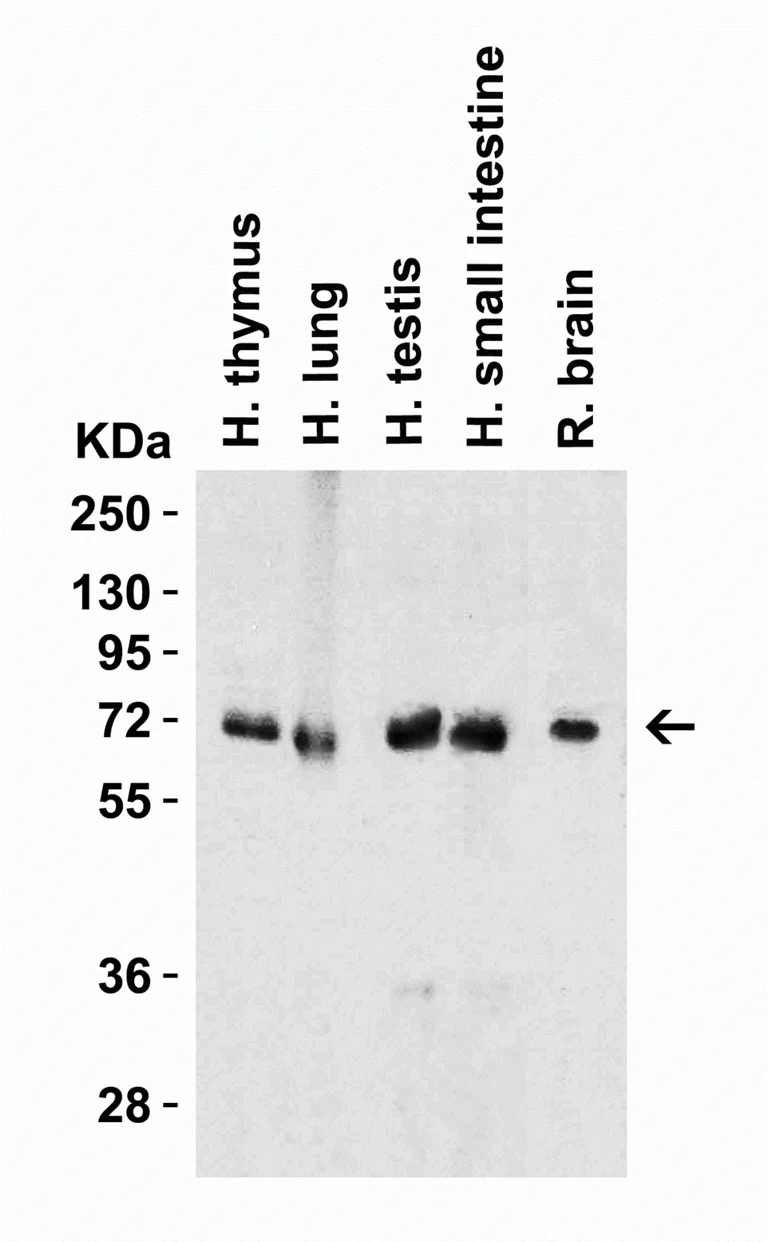 Western blot - Anti-c-IAP1 and c-IAP2 antibody (AB25939)