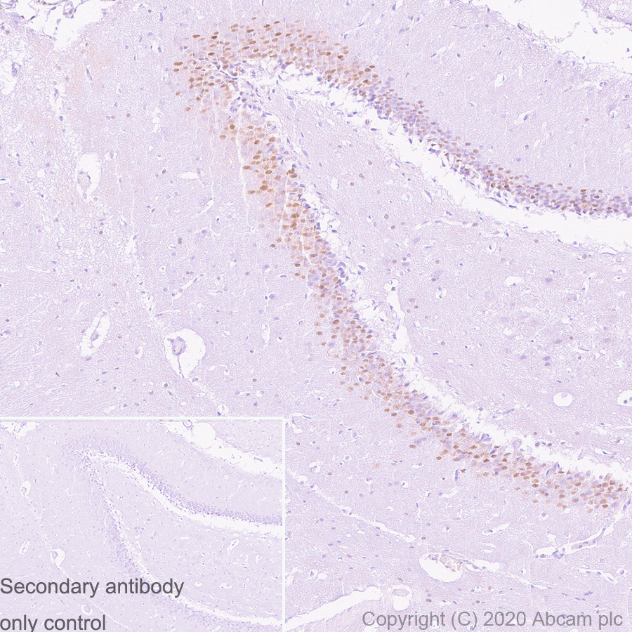 Immunohistochemistry (Formalin/PFA-fixed paraffin-embedded sections) - Anti-c-Jun antibody [3/Jun] (ab280089), expandable thumbnail