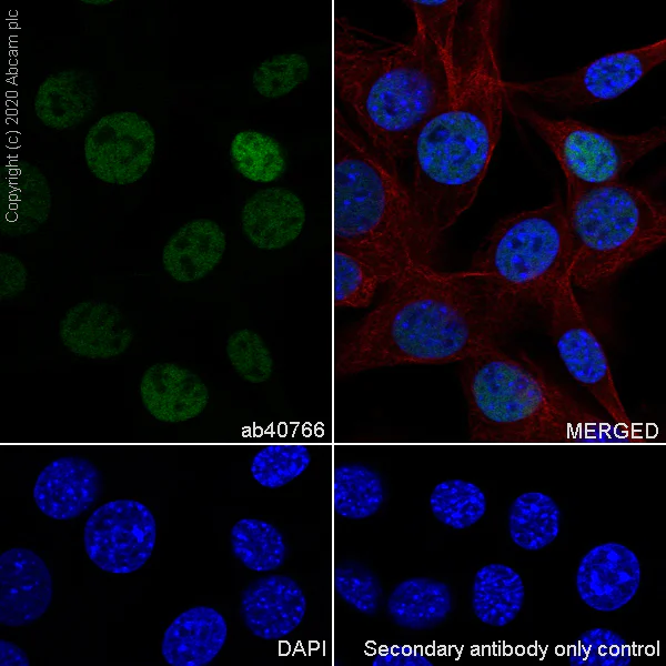 Anti-c-Jun antibody [EP693Y] (ab40766) | Abcam