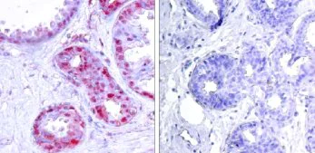 Immunohistochemistry (Formalin/PFA-fixed paraffin-embedded sections) - Anti-c-Jun (phospho S243) antibody (AB28846)