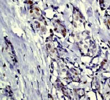 Immunohistochemistry (Formalin/PFA-fixed paraffin-embedded sections) - Anti-c-Jun (phospho S63) antibody [Y172] (AB32385)