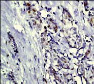 Immunohistochemistry (Formalin/PFA-fixed paraffin-embedded sections) - Anti-c-Jun (phospho S63) antibody [Y172] - BSA and Azide free (AB227533)