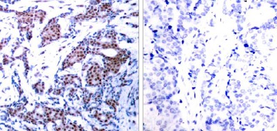 Immunohistochemistry (Formalin/PFA-fixed paraffin-embedded sections) - Anti-c-Jun (phospho S73) antibody (AB30620), expandable thumbnail
