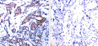 Immunohistochemistry (Formalin/PFA-fixed paraffin-embedded sections) - Anti-c-Jun (phospho S73) antibody (AB30620)