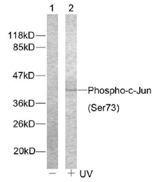 Western blot - Anti-c-Jun (phospho S73) antibody (AB30620)