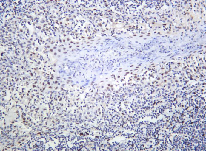 Immunohistochemistry (Formalin/PFA-fixed paraffin-embedded sections) - Anti-c-Jun (phospho s73) + JunD (phospho s100) antibody [SR1627] (AB326669)