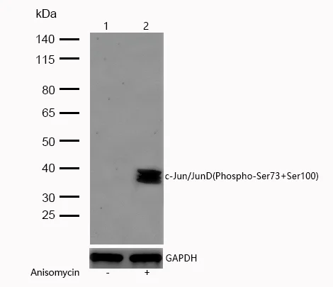 Western blot - Anti-c-Jun (phospho s73) + JunD (phospho s100) antibody [SR1627] (AB326669)