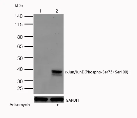 Western blot - Anti-c-Jun (phospho s73) + JunD (phospho s100) antibody [SR1627] (AB326669)