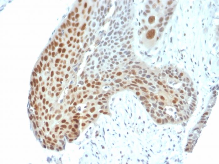 Immunohistochemistry (Formalin/PFA-fixed paraffin-embedded sections) - Anti-c-Jun (phospho T91 + T93) antibody [C-J 4C4/1] (AB270242), expandable thumbnail