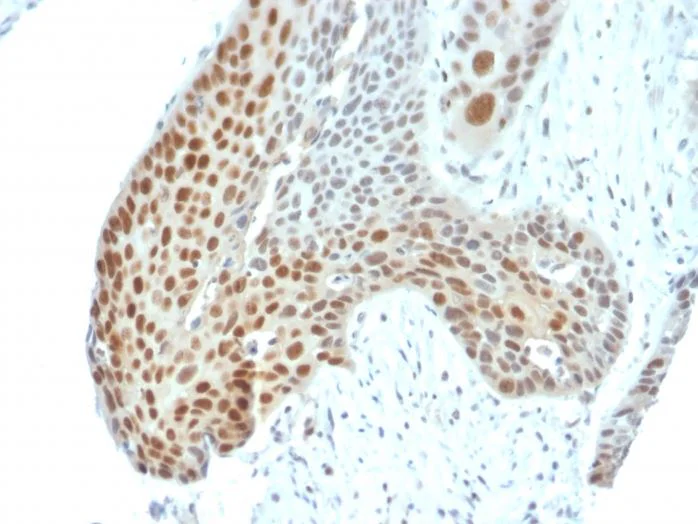 Immunohistochemistry (Formalin/PFA-fixed paraffin-embedded sections) - Anti-c-Jun (phospho T91 + T93) antibody [C-J 4C4/1] (AB270242)