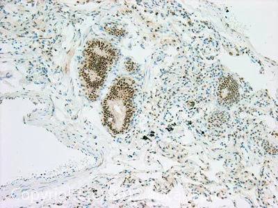 Immunohistochemistry (Formalin/PFA-fixed paraffin-embedded sections) - Anti-c-Jun (phospho T91 + T93) antibody [C-J 4C4] (AB13671)