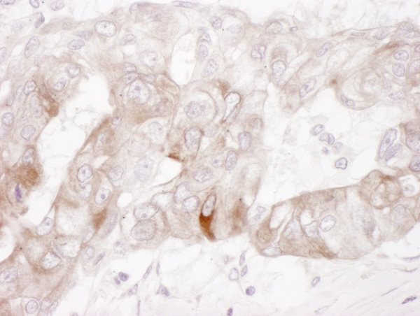Immunohistochemistry (Formalin/PFA-fixed paraffin-embedded sections) - Anti-c-Kit antibody (AB114992), expandable thumbnail