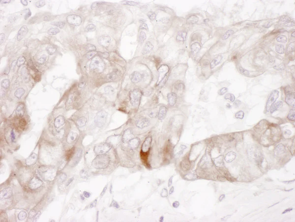 Immunohistochemistry (Formalin/PFA-fixed paraffin-embedded sections) - Anti-c-Kit antibody (AB114992)