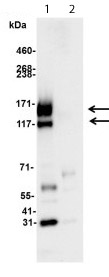 Immunoprecipitation - Anti-c-Kit antibody (AB114992), expandable thumbnail