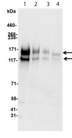Western blot - Anti-c-Kit antibody (AB114992), expandable thumbnail