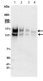 Western blot - Anti-c-Kit antibody (AB114992)
