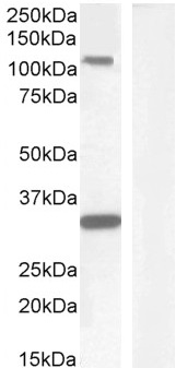 Western blot - Anti-c-Kit antibody (AB178527)