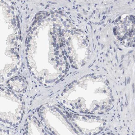Immunohistochemistry (Formalin/PFA-fixed paraffin-embedded sections) - Anti-c-Kit antibody (AB260048)