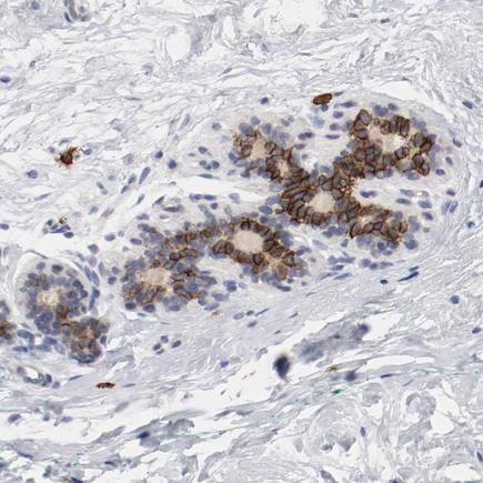 Immunohistochemistry (Formalin/PFA-fixed paraffin-embedded sections) - Anti-c-Kit antibody (AB260048)