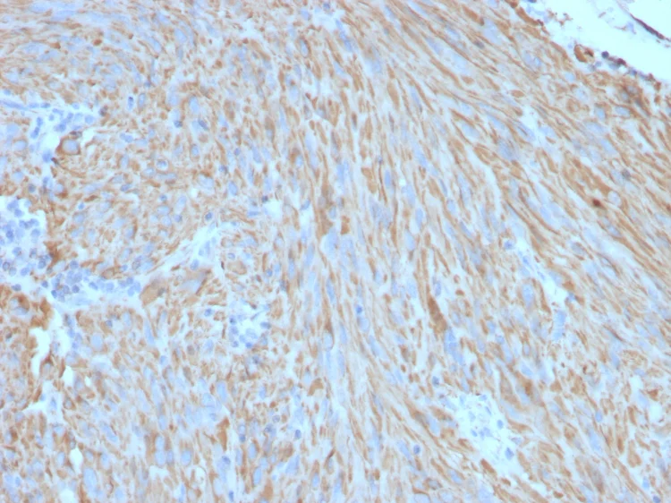 Immunohistochemistry (Formalin/PFA-fixed paraffin-embedded sections) - Anti-c-Kit antibody [C117/370] (AB187371)