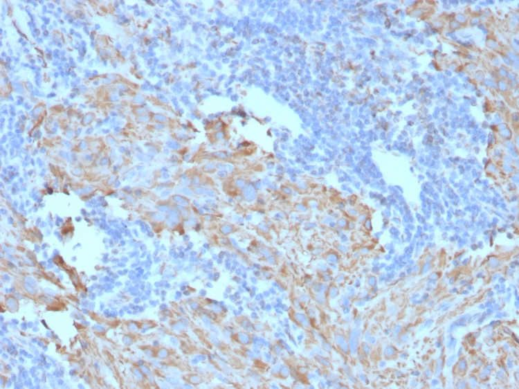 Immunohistochemistry (Formalin/PFA-fixed paraffin-embedded sections) - Anti-c-Kit antibody [C117/370] (AB187371)