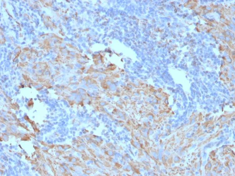 Anti-c-Kit antibody [C117/370] (ab187371) | Abcam