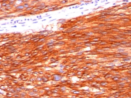 Immunohistochemistry (Formalin/PFA-fixed paraffin-embedded sections) - Anti-c-Kit antibody [C117/370] - BSA and Azide free (AB212518)