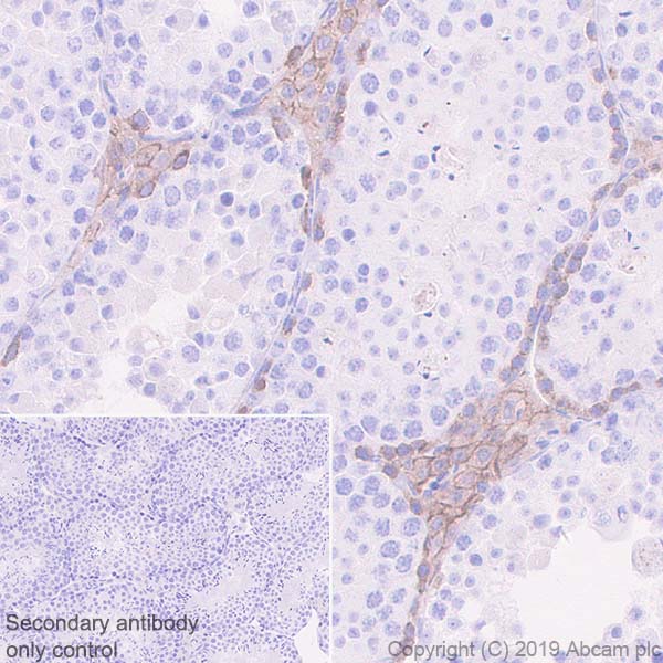 Immunohistochemistry (Formalin/PFA-fixed paraffin-embedded sections) - Anti-c-Kit antibody [EPR22566-205] - BSA and Azide free (AB254200), expandable thumbnail