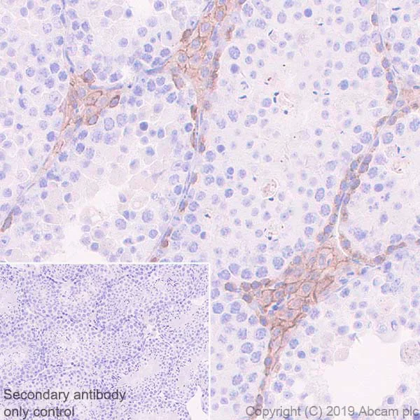 Immunohistochemistry (Formalin/PFA-fixed paraffin-embedded sections) - Anti-c-Kit antibody [EPR22566-205] - BSA and Azide free (AB254200)