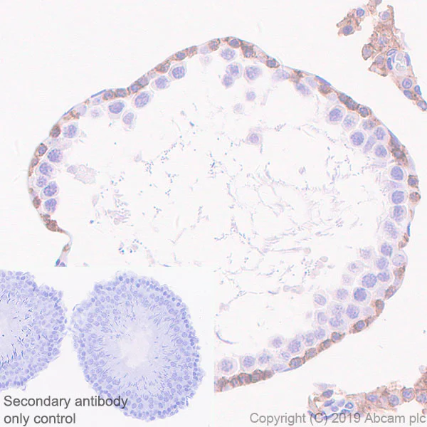 Immunohistochemistry (Formalin/PFA-fixed paraffin-embedded sections) - Anti-c-Kit antibody [EPR22566-205] - BSA and Azide free (AB254200)