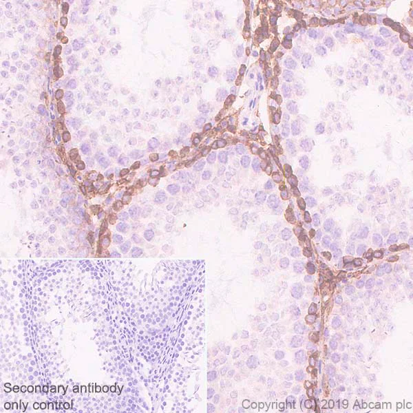 Immunohistochemistry (Formalin/PFA-fixed paraffin-embedded sections) - Anti-c-Kit antibody [EPR22566-344] (AB256345)