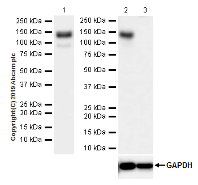 Western blot - Anti-c-Kit antibody [EPR22566-344] (AB256345)