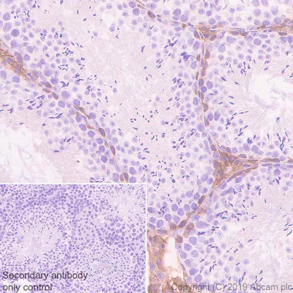 Immunohistochemistry (Formalin/PFA-fixed paraffin-embedded sections) - Anti-c-Kit antibody [EPR22566-344] - BSA and Azide free (AB272020)