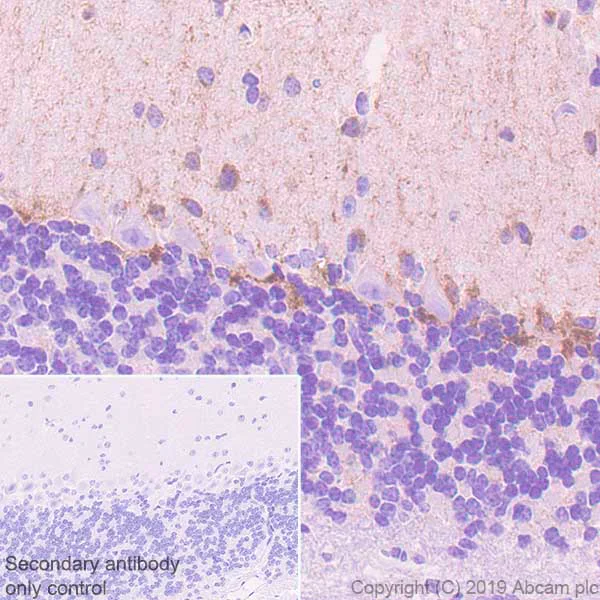 Immunohistochemistry (Formalin/PFA-fixed paraffin-embedded sections) - Anti-c-Kit antibody [EPR22566-344] - BSA and Azide free (AB272020)