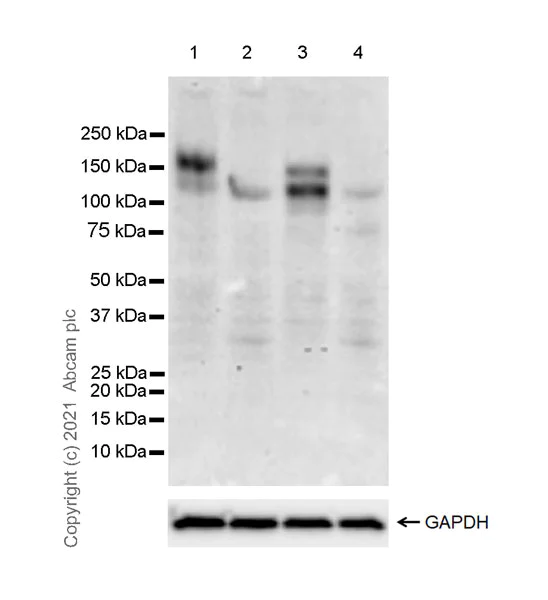 Western blot - Anti-c-Kit antibody [EPR25707-134] - BSA and Azide free (AB283666)