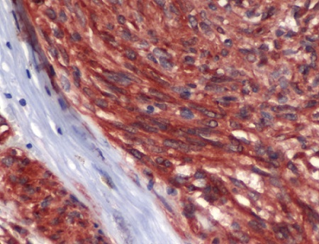 Immunohistochemistry (Formalin/PFA-fixed paraffin-embedded sections) - Anti-c-Kit antibody - Hematopoietic Stem Cell Marker (AB227749), expandable thumbnail