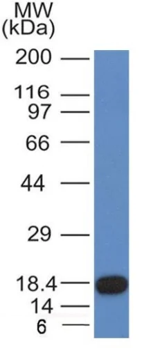 Western blot - Anti-c-Kit antibody [KIT/982] (AB233902)
